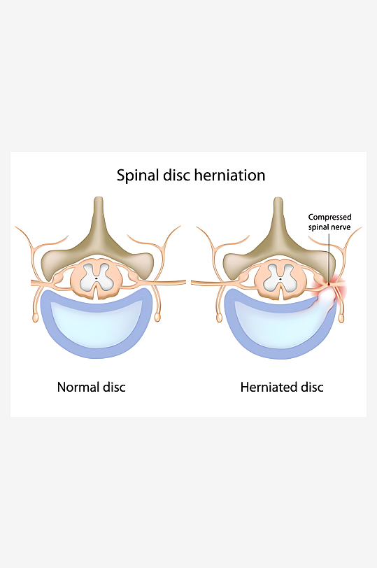 医学医疗人体示意图-众图网