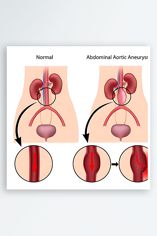 医学医疗人体示意图-众图网