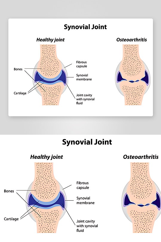 医学医疗人体示意图-众图网