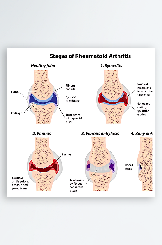 医学医疗人体示意图-众图网