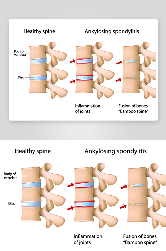 医学医疗人体示意图-众图网