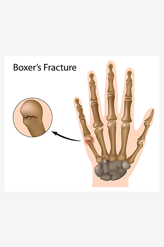 医学医疗人体示意图-众图网