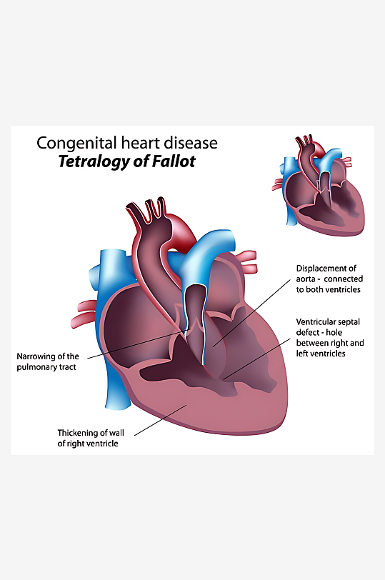 医疗医学人体示意图-众图网