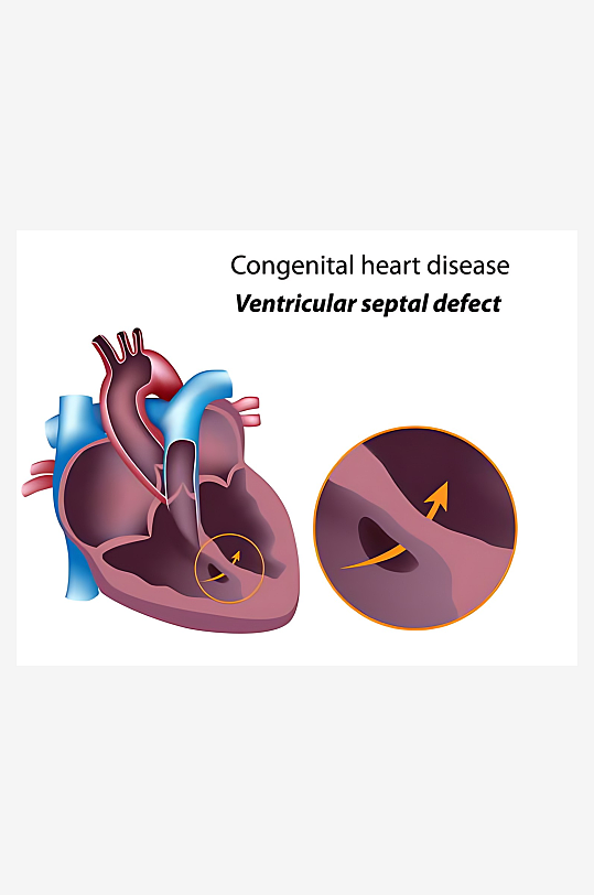 医疗医学人体示意图-众图网