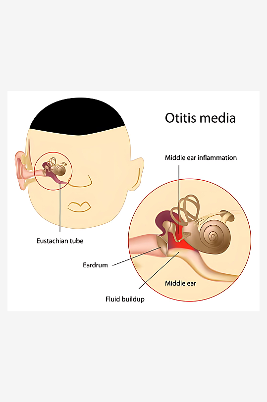 医疗医学人体示意图-众图网