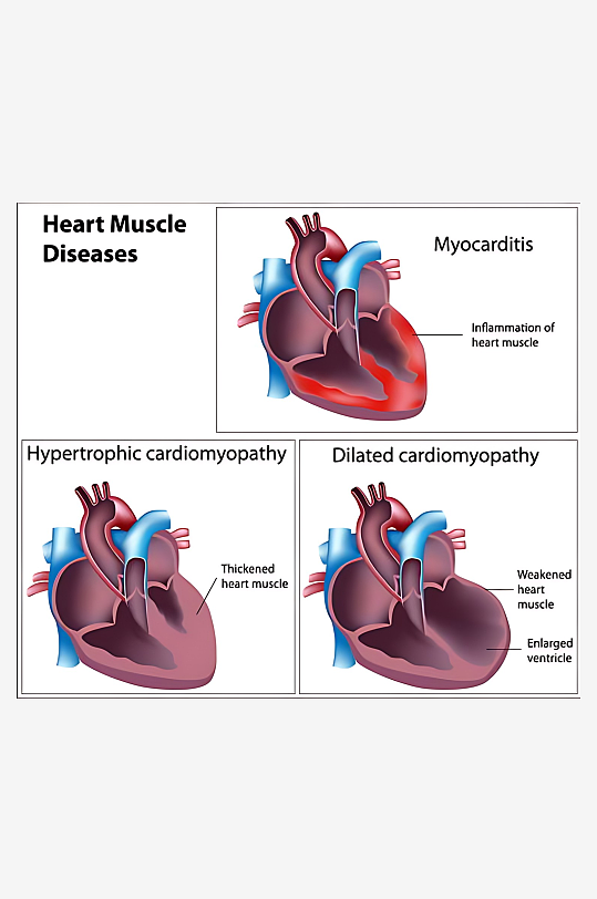 医疗医学人体示意图-众图网