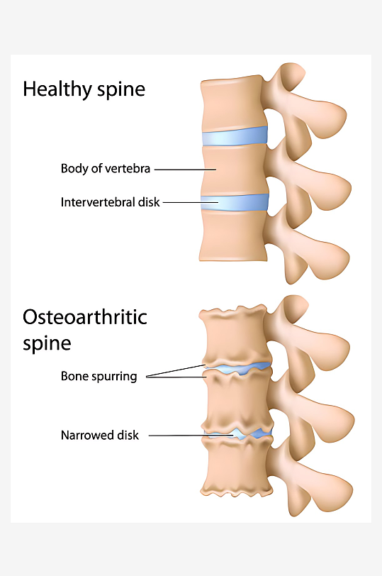 医疗医学人体示意图-众图网