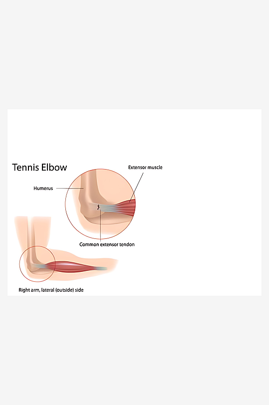 医疗医学人体示意图-众图网