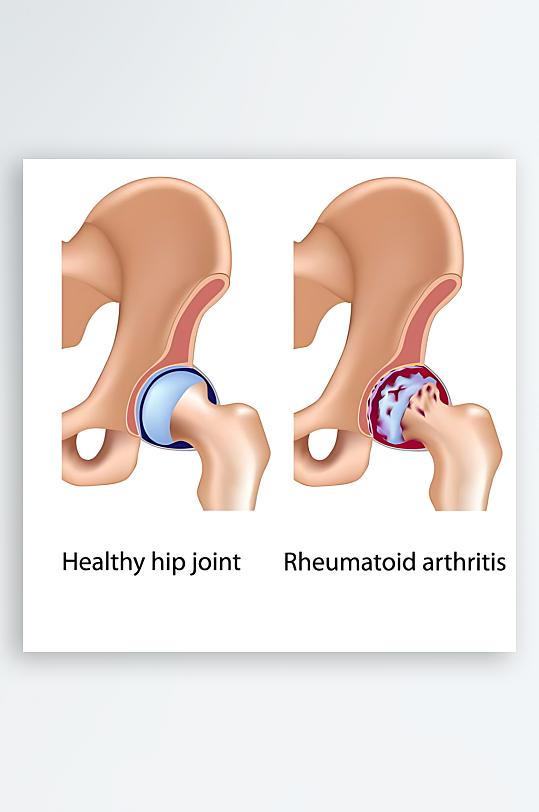 医疗医学人体示意图-众图网