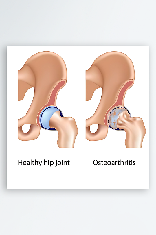 医疗医学人体示意图-众图网