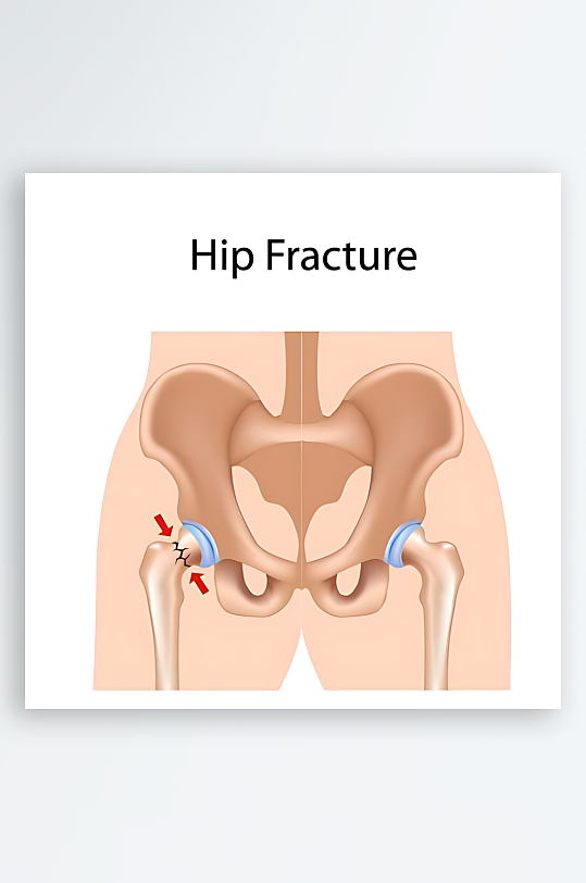 医疗医学人体示意图-众图网