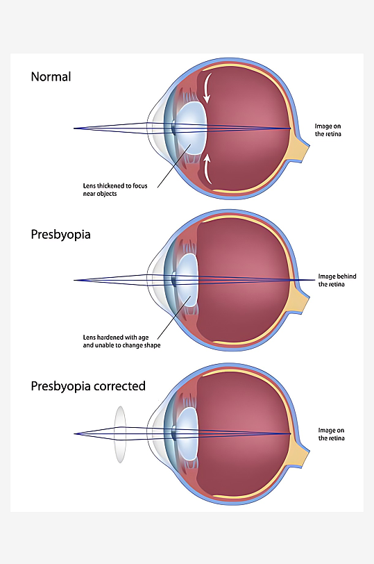 医疗医学人体示意图-众图网