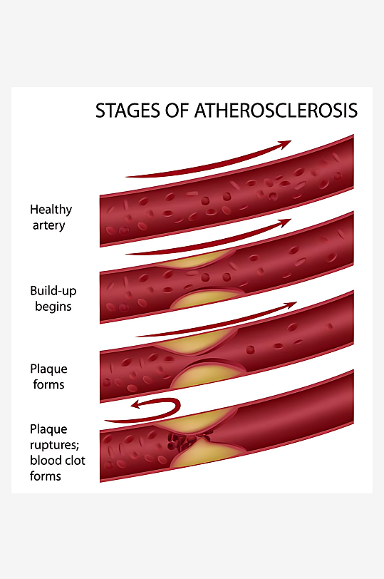 医疗医学人体示意图-众图网