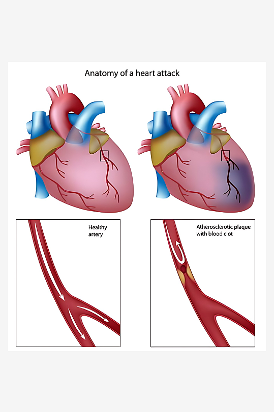 医学医疗人体示意图-众图网