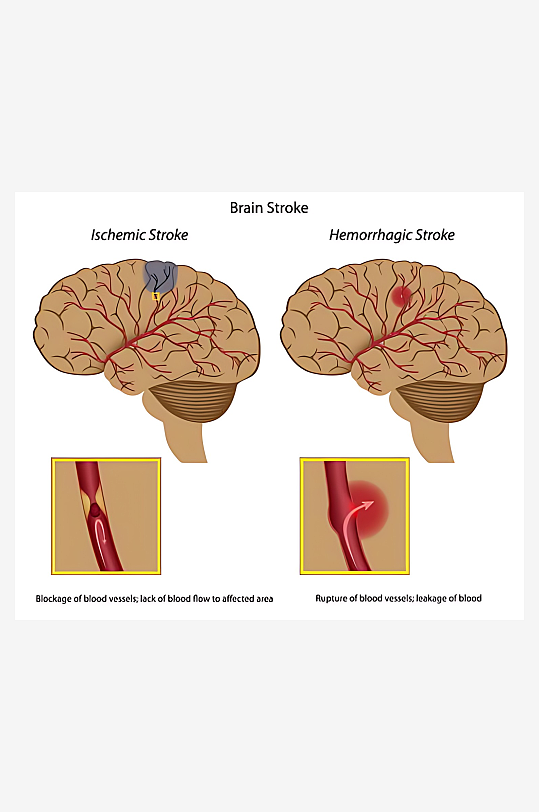 医学医疗人体示意图-众图网