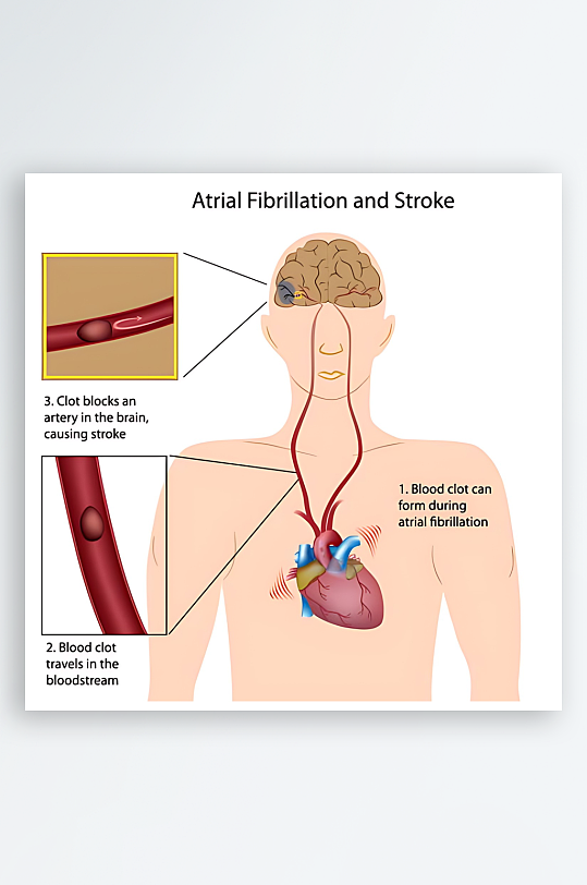 医学医疗人体示意图-众图网