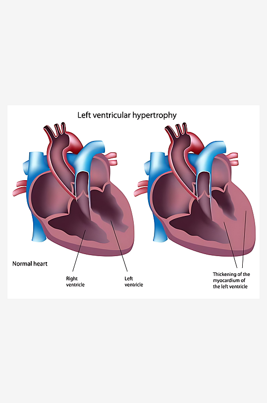 医学医疗人体示意图-众图网