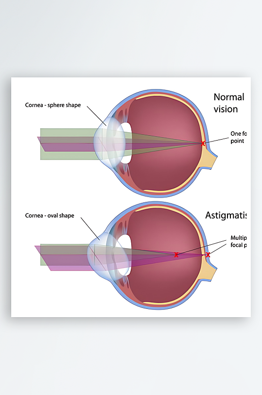 医学医疗人体示意图-众图网