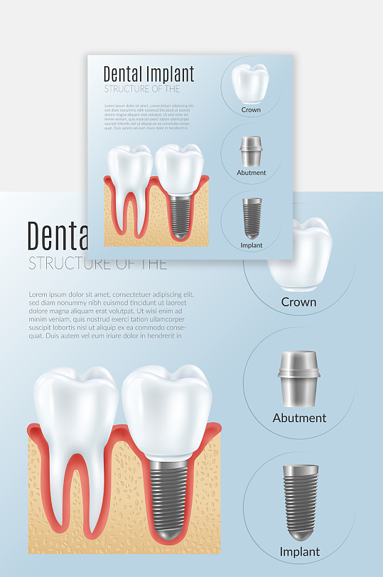 种牙流程口腔牙齿设计素材