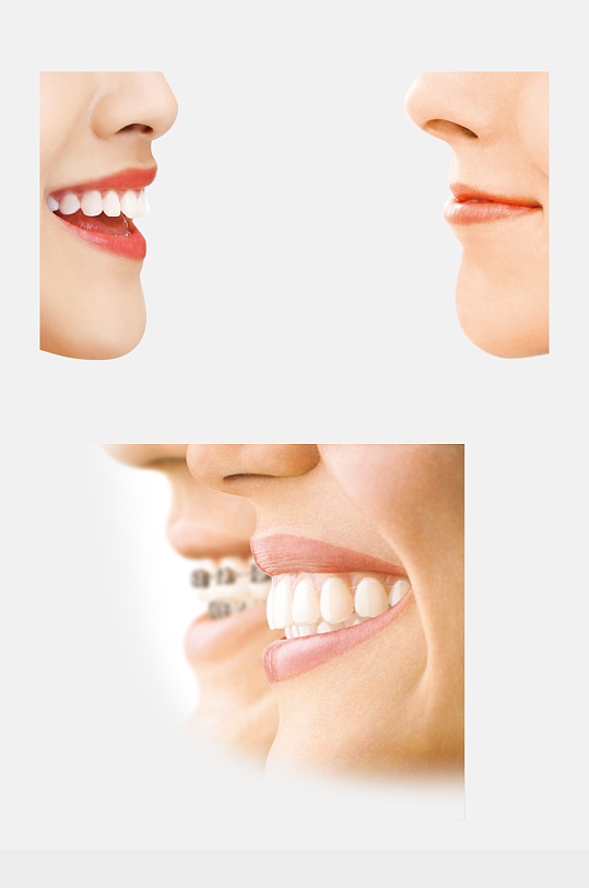 口腔牙齿矫正微笑图片PSD设计素材