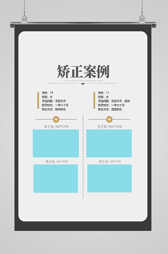 白色简约现代医院医美案例对比海报