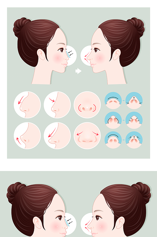 手绘整形隆鼻步骤