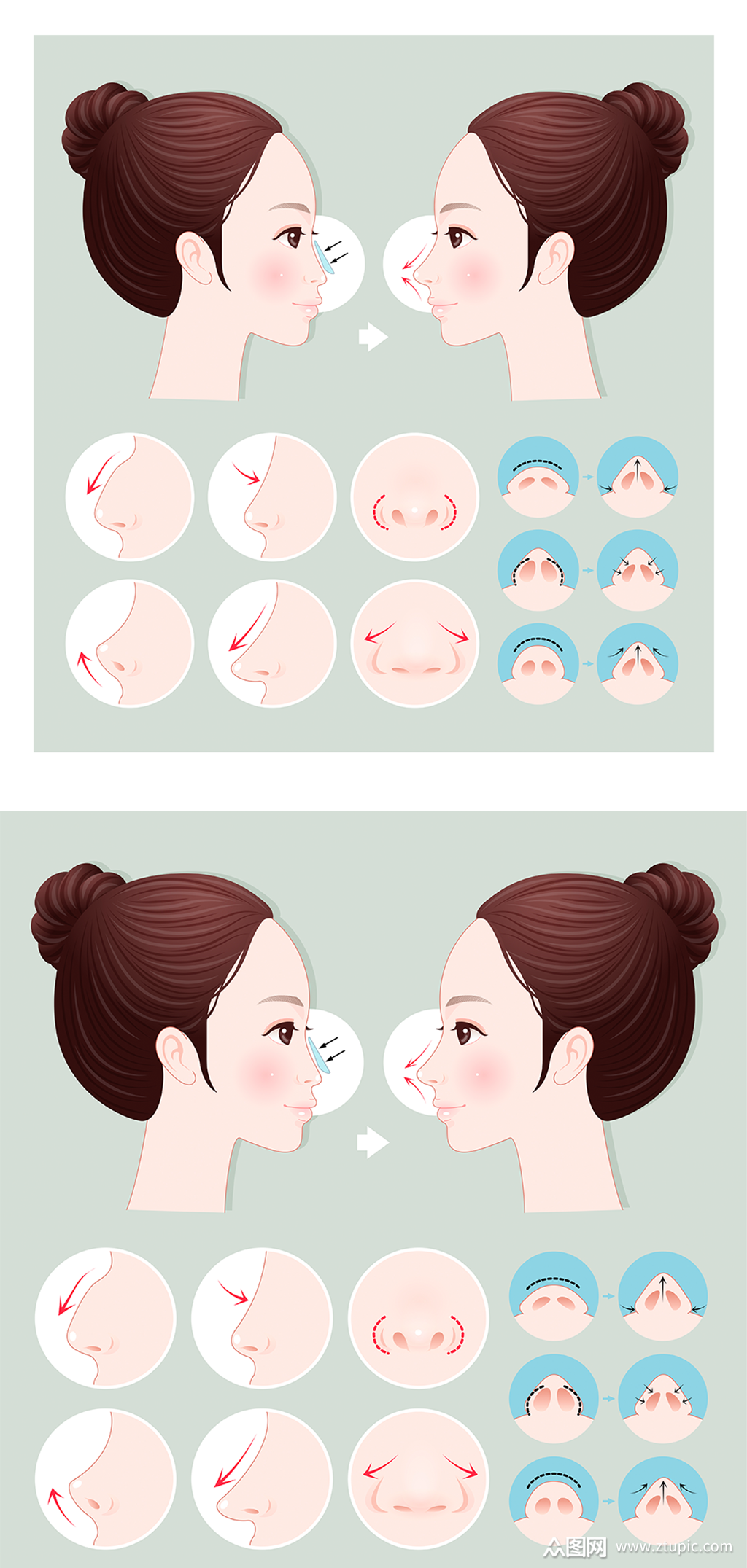 手绘整形隆鼻步骤