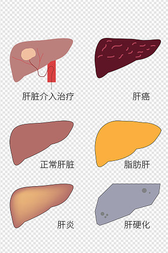 肝病肝脏肝硬化脂肪肝肝介入