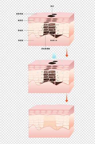 3D立体皮肤层次淡化色斑免扣元素