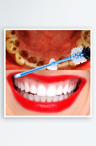 牙齿修牙牙刷对比图
